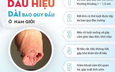 Dài bao quy đầu: Cách nhận biết và xử lý hiệu quả