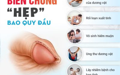 Hẹp bao quy đầu ở người lớn – Tình trạng đáng lo ngại!