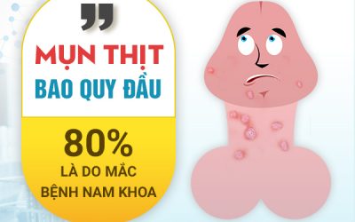 Mụn thịt ở bao quy đầu coi chừng mắc bệnh lý nam khoa nguy hiểm