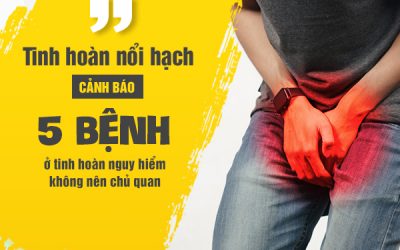 Tinh hoàn nổi hạch – dấu hiệu bất thường không nên chủ quan