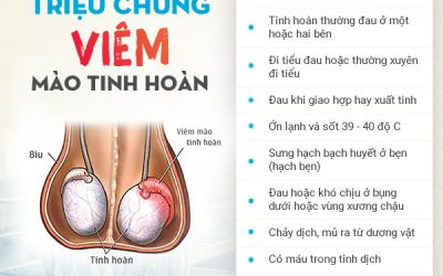 Bác sĩ hướng dẫn cách nhận biết triệu chứng viêm mào tinh hoàn