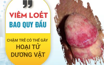 Viêm loét bao quy đầu – chậm trễ khám có thể gây hoại tử dương vật