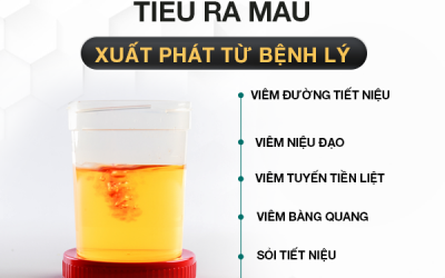 Tiểu ra máu nguyên nhân do đâu? – Cảnh giác với nhiều bệnh lý nguy hiểm