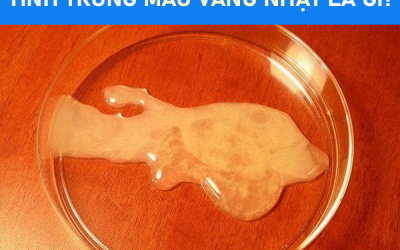 Tinh trùng có màu vàng nhạt cảnh báo nhiều bệnh lý ở nam giới
