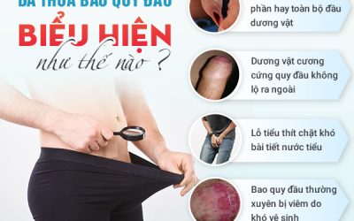 Da thừa bao quy đầu có cần cắt không? Nên cắt bằng phương pháp nào hiệu quả?