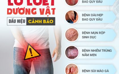 Dương vật bị loét 90% là do nguyên nhân viêm nhiễm nam khoa