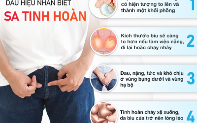 Sa tinh hoàn ở nam giới: Dấu hiệu nguy hiểm, không nên chủ quan
