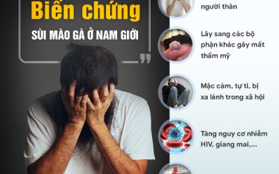 Sùi mào gà ở nam giới: Những điều cần biết để điều trị hiệu quả