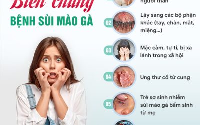 Điều trị bệnh sùi mào gà hiệu quả với 2 phương pháp mới IRA & Ala-Pdt 3